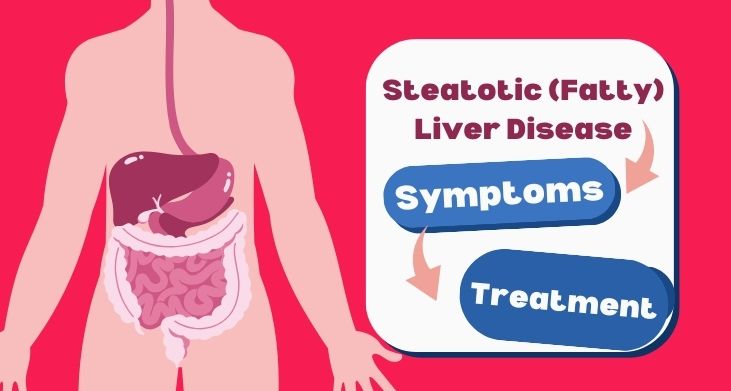 Steatotic (Fatty) Liver Disease: Symptoms & Treatment