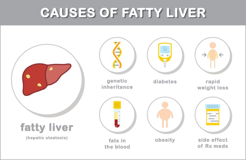 The role of nutrition in fatty liver disease 3 image 3