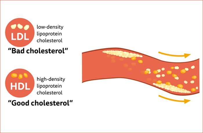 The Cholesterol Diet: An Effective Way to a Healthy, Happy and Long Life 1 image 2