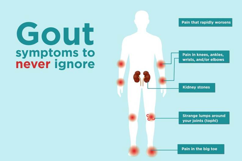 Ways to Reduce Uric Acid in the Body 1 image 1