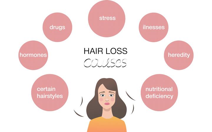 Reasons Your Hair Is Falling Out 1 image 2 1